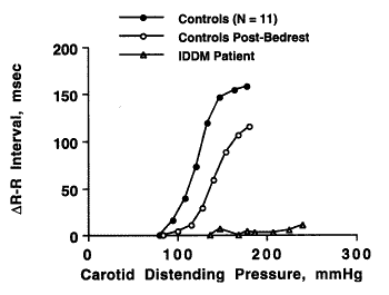 Fig. 1. Stimulus-response relationship of the carotid-cardiac baroreflex in the IDDM patient (open triangles) compared to the average response of 11 healthy subjects before (closed circles) and after (open circles) 30 d of bedrest. Data modified from Convertino et al. (5).